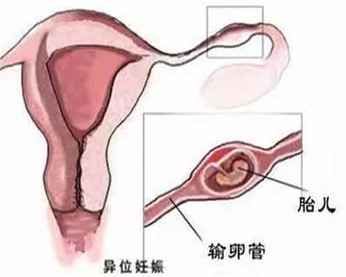 云南代孕产子网,云南代孕机构安全吗,孕妇30周头晕是怎么回事